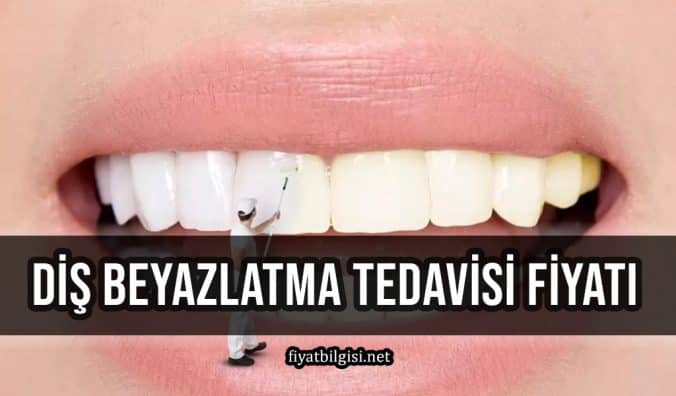 Diş Beyazlatma Tedavisi Fiyatı
