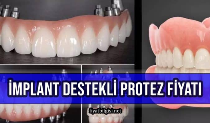 İmplant Destekli Protez Fiyatları