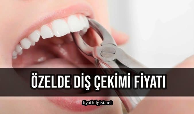 Özelde Diş Çekimi Fiyatı
